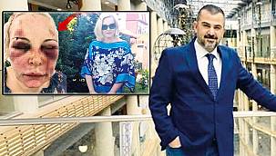 İstanbul'daki otelde dehşet! Kadına 2 gün işkence yaptı