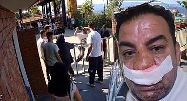 Turizm düşmanı magandalar! Turistlerin kazıklanmasına izin vermeyen tur şoförünü hastanelik ettiler