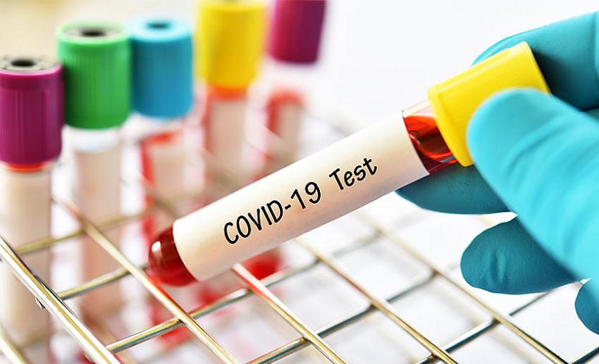 Ülkeye gelen, karantinaya girmek istemeyenlere havalimanında korona testi! İşte fiyatı