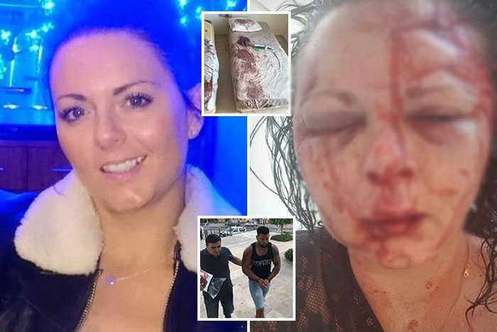 İngiliz turistin Marmarisʹte yaşadığı kabus The Sunʹun manşetinde
